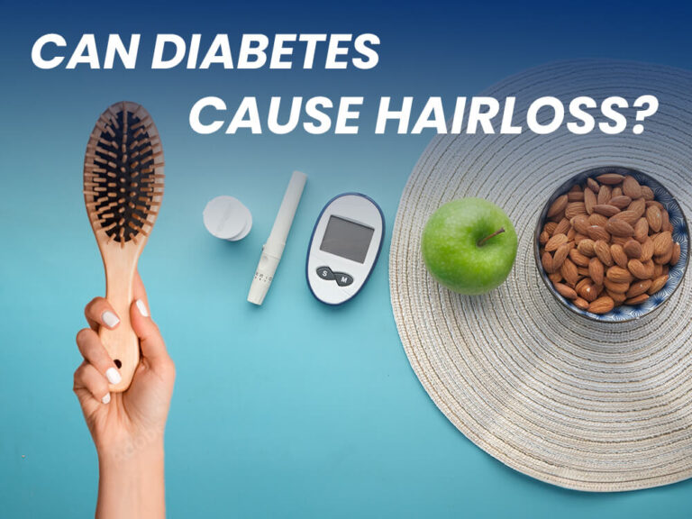 Blog cover of article "Can diabetes cause hair loss?"