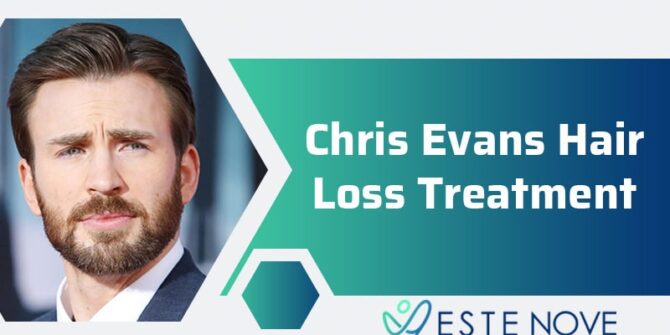 Chris Evans Hair Loss Treatment