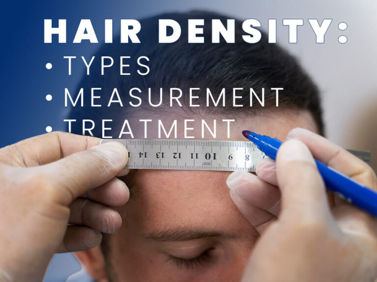Hair Density