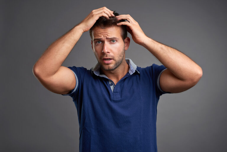 Young man worrying about hair loss