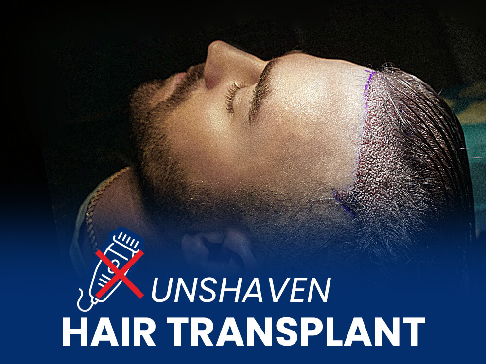 Man in a hair transplantation procedure with text saying unshaven hair transplant