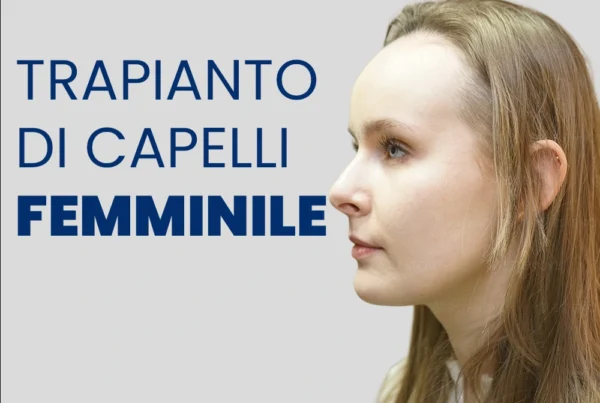 Trapianto di Capelli per Donne in Turchia