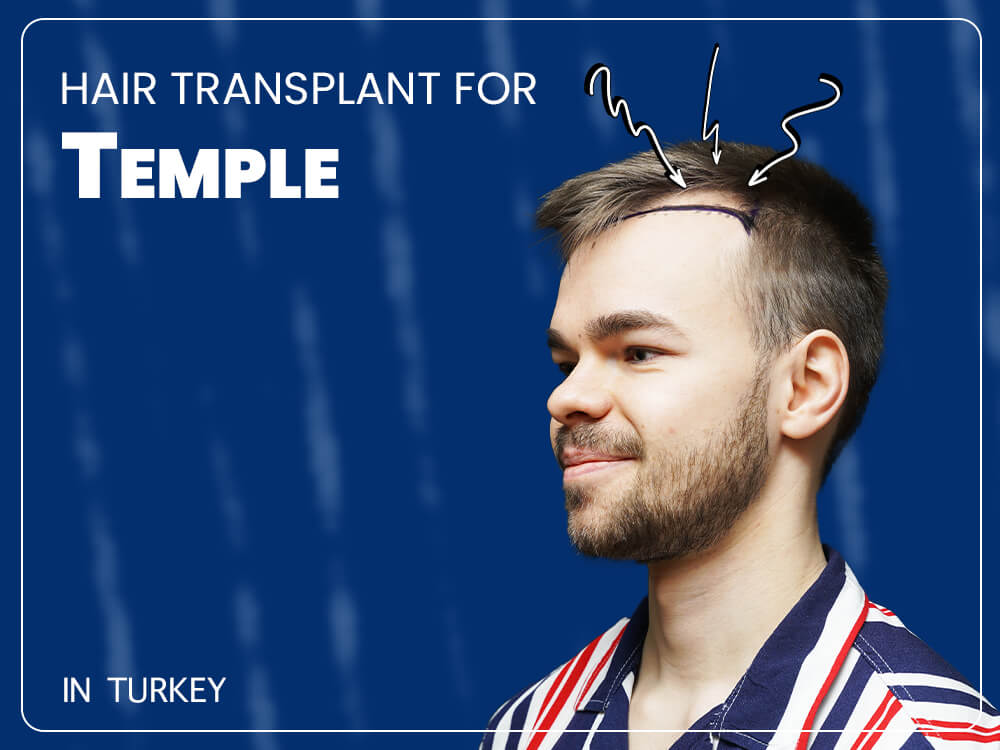 text saying hair transplant for temple with man picture with receding hairline