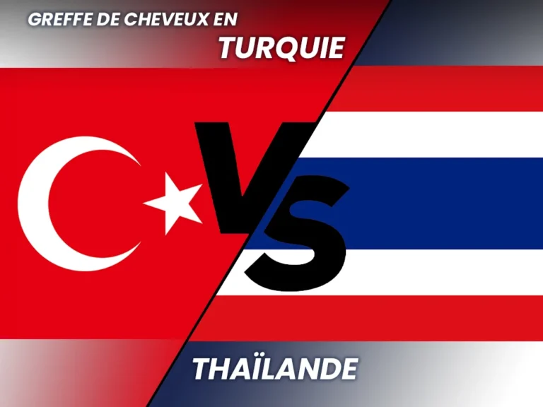 Greffe de Cheveux Thailand vs Turquie