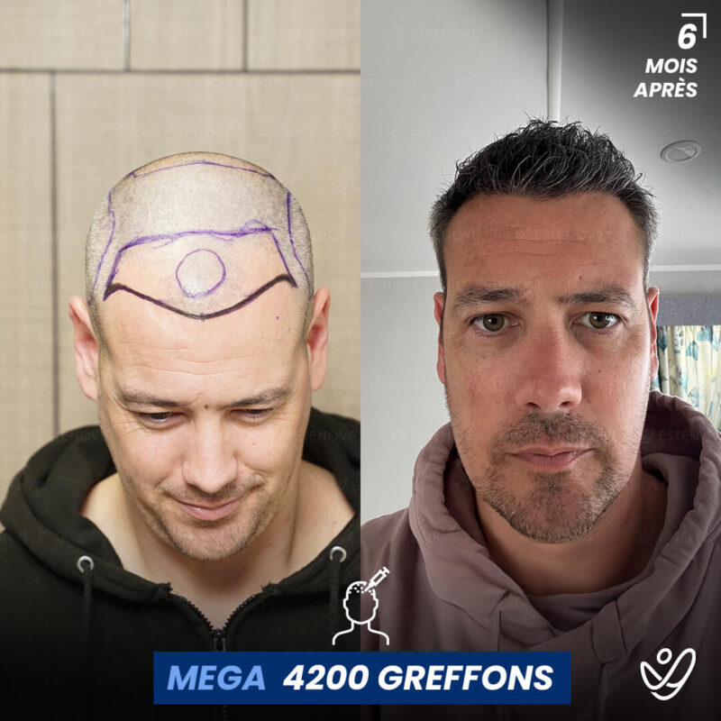 B&A-POST_Template_FRA2 B&A-POST_Template_FRA2