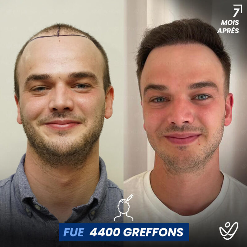 B&A-POST_Template_FRA5 B&A-POST_Template_FRA5