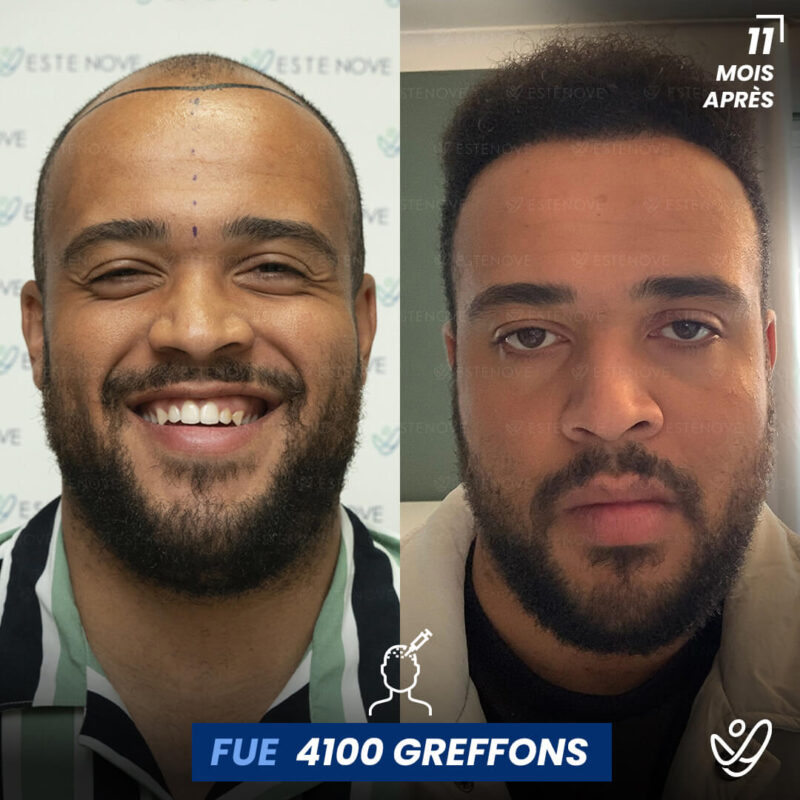 B&A-POST_Template_FRA8 B&A-POST_Template_FRA8