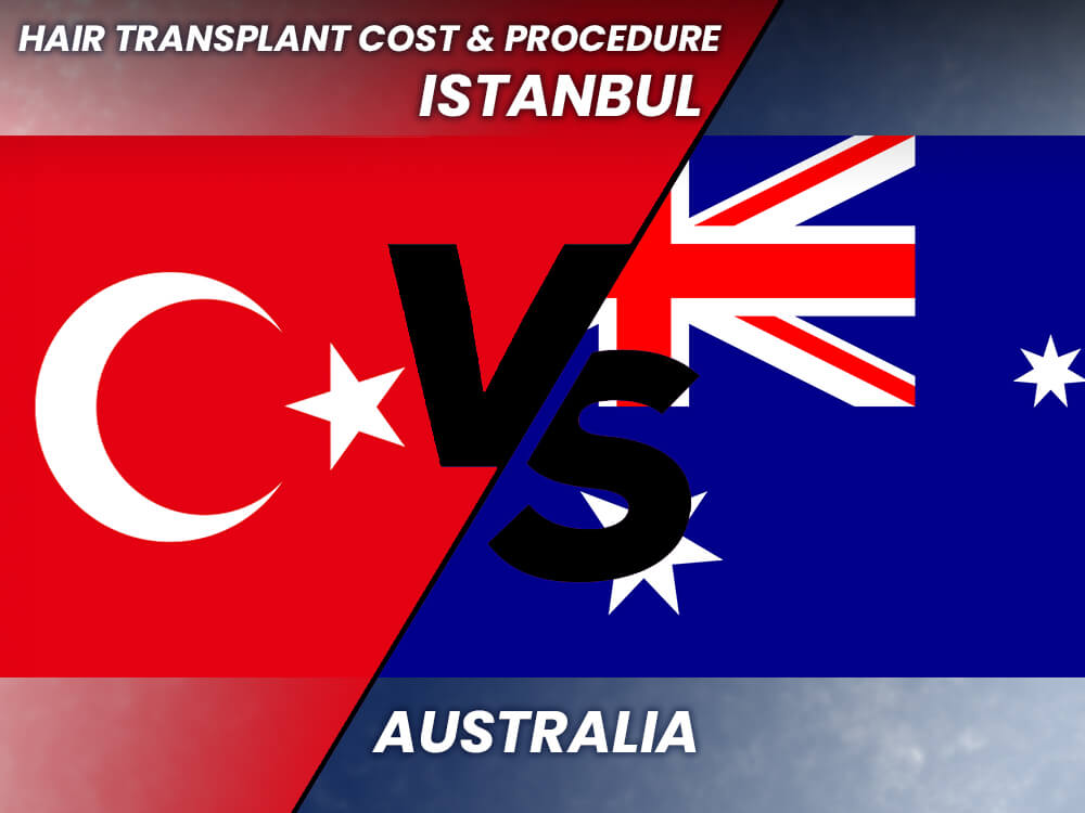 hair transplant australia vs turkey