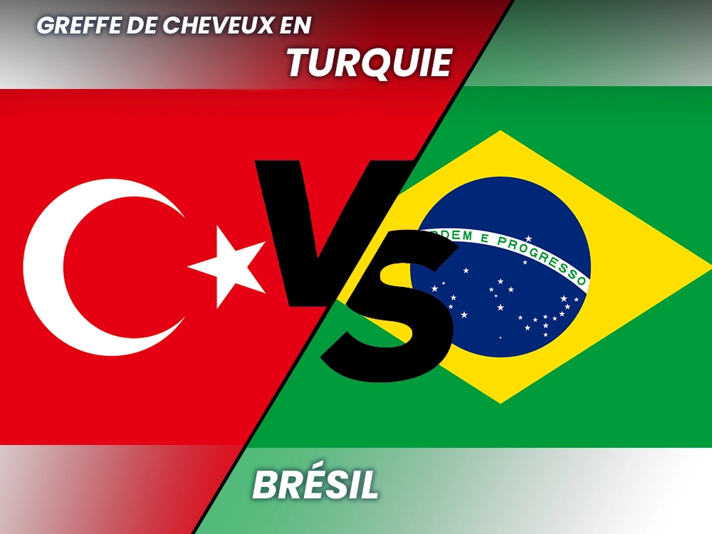 greffe de cheveux en turquie vs bresil