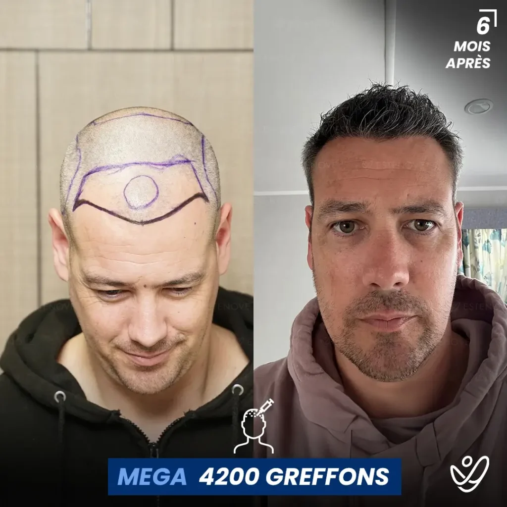 B&A-POST_Template_FRA2