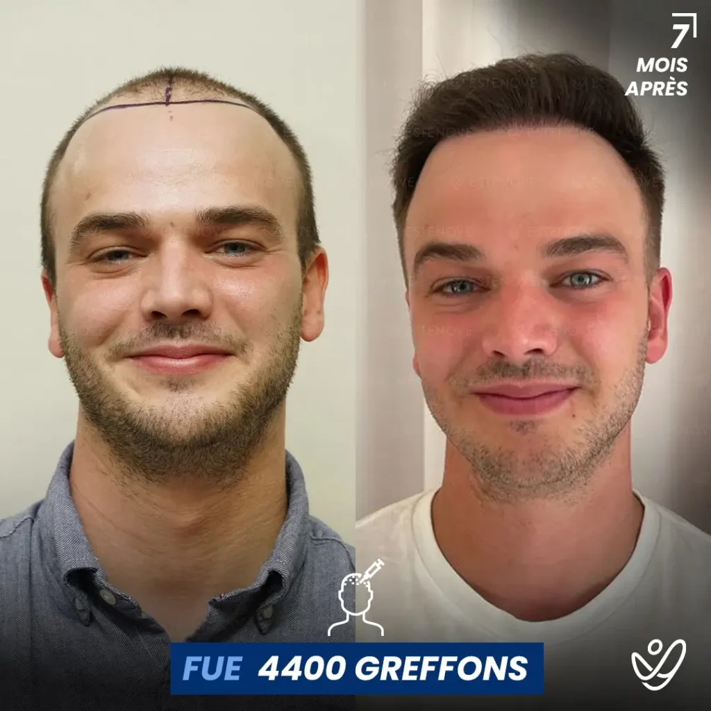 B&A-POST_Template_FRA5