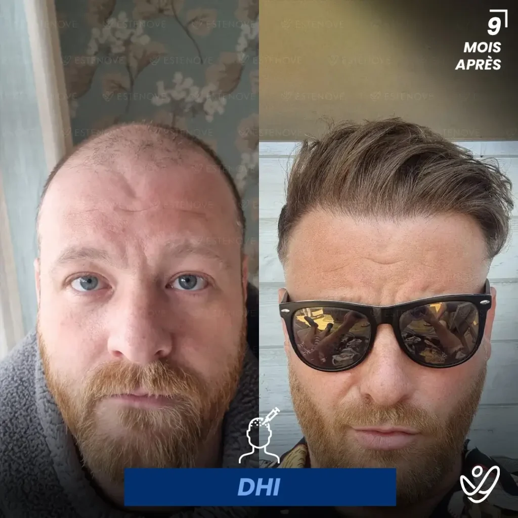 B&A-POST_Template_FRA6