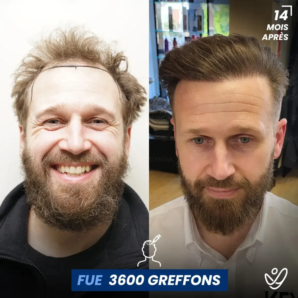 B&A-POST_Template_FRA7