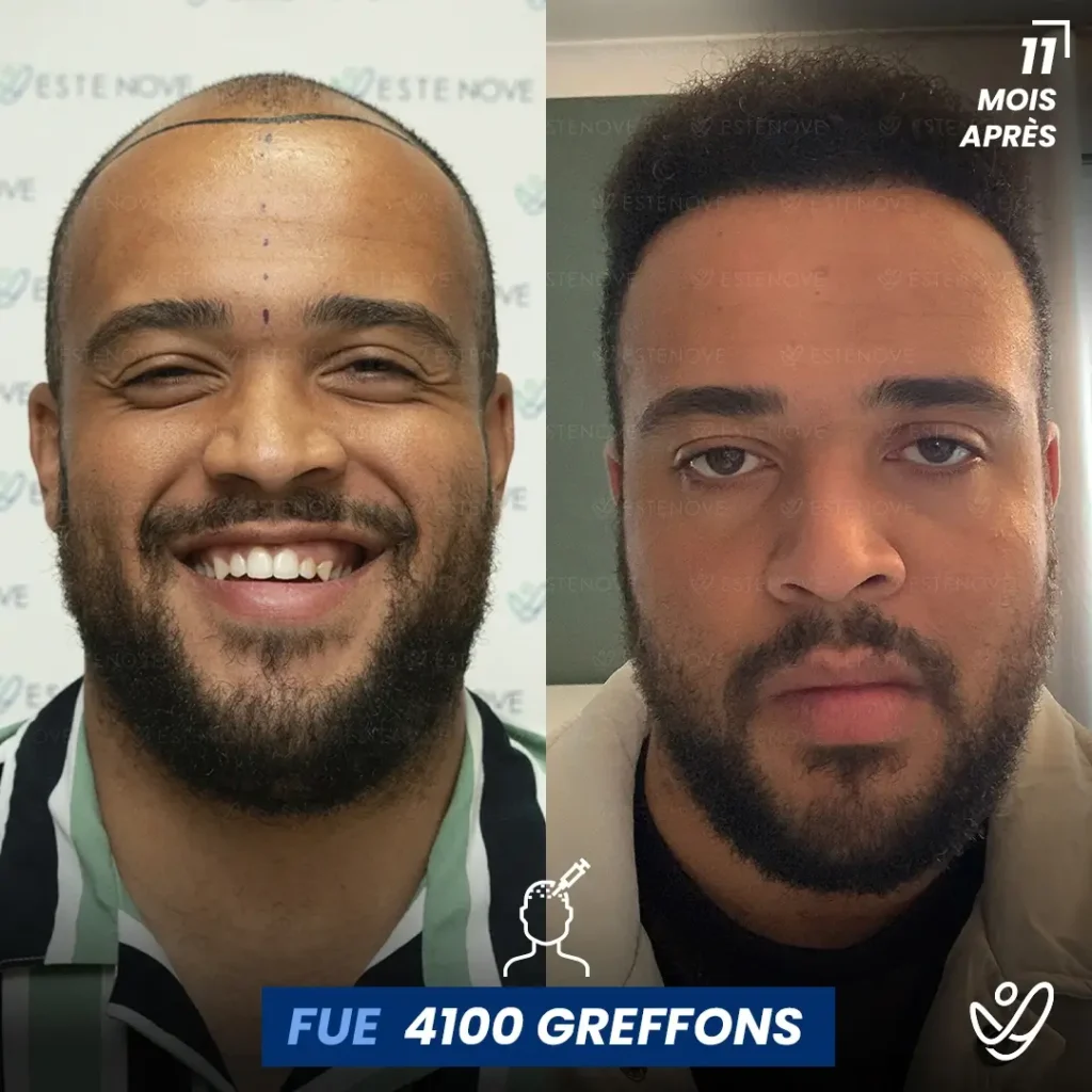 B&A-POST_Template_FRA8