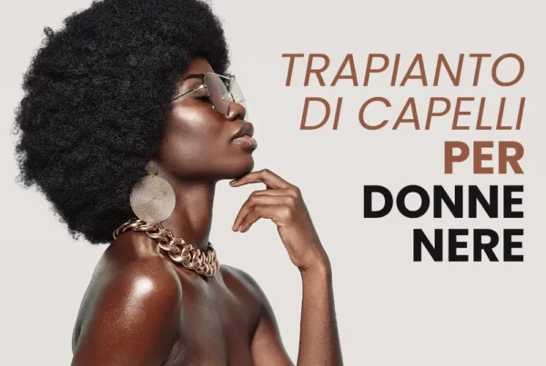 Trapianto di capelli per donne nere
