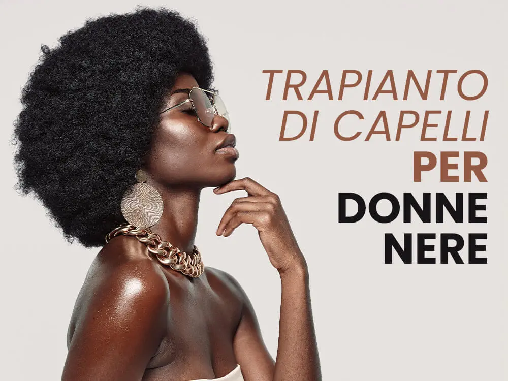 Trapianto di capelli per donne nere